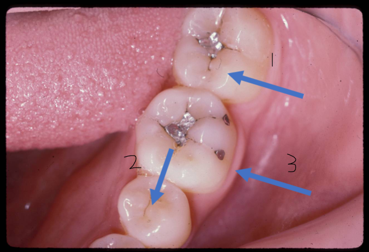 term image