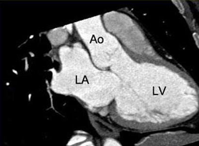 <p>Cardiac MRI- Cardiac Axes</p>