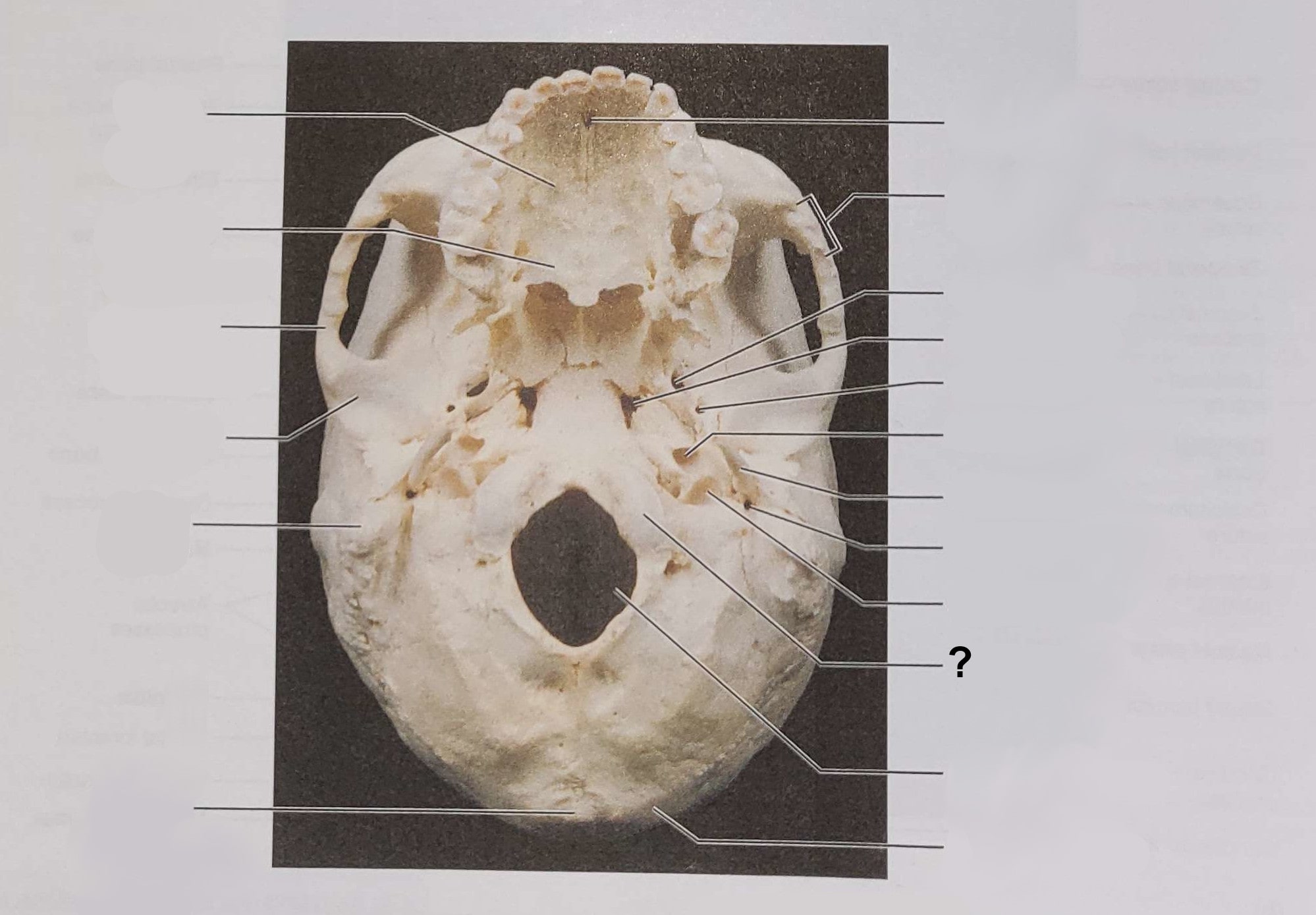 <p>Name the indicated structure</p>