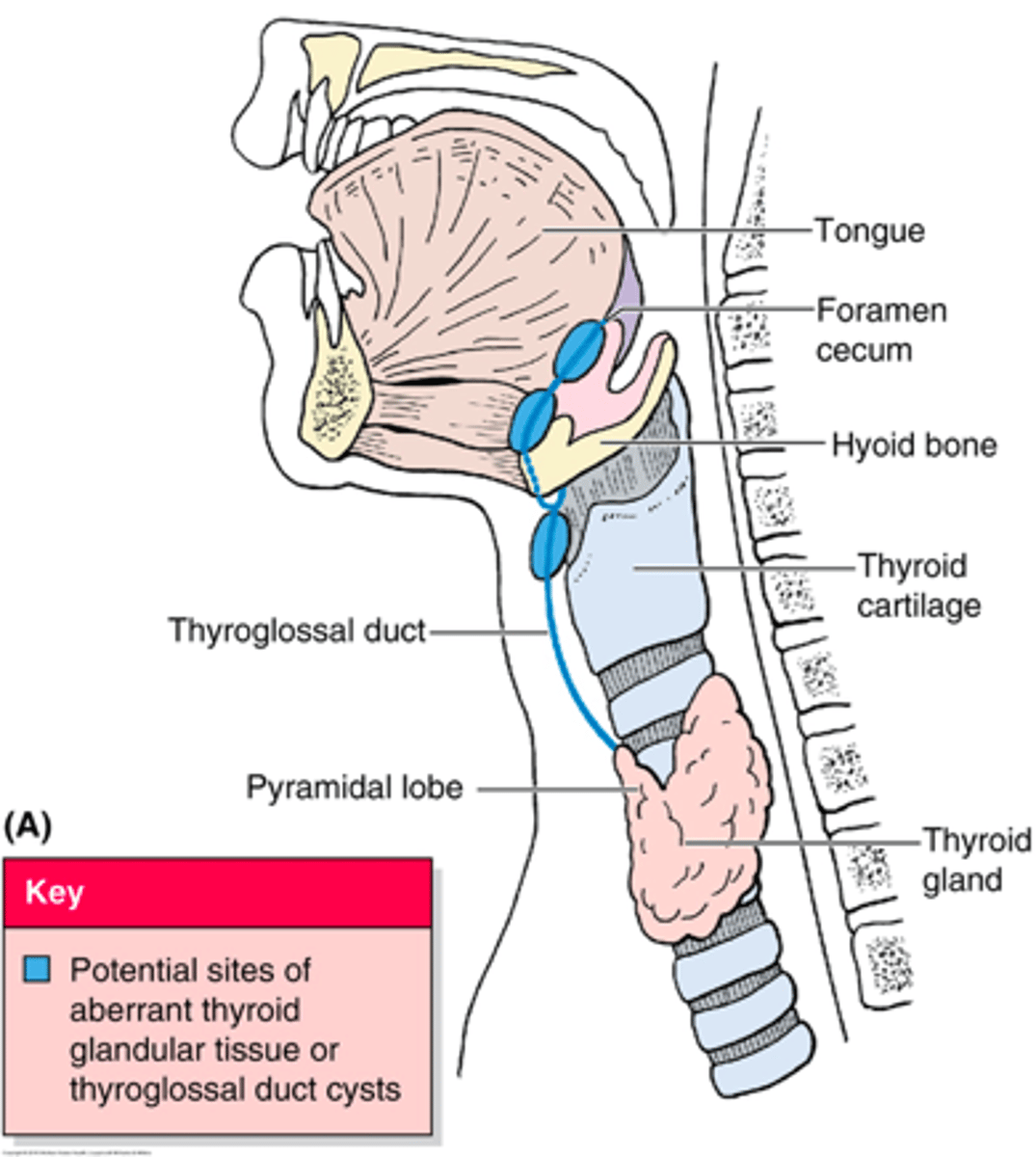 <p>Define Condition:</p><p>Thyroid tissue located OUTSIDE of normal position in anterior neck</p><p>-Hx/Path: MC Secondary to failure of embryological descent</p><p>-Sx/PE:</p><p>&gt; MC at Base of Tongue (LINGUAL)</p><p>-Prog: Removal --&gt; Hypothyroidism (if it's the only thyroid tissue present)</p>
