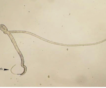 <p>Capillria philippinensis w.m</p>