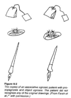 <p><span><span>The inability to recognise or assign meaning to objects despite having intact sensory perception.</span></span></p>