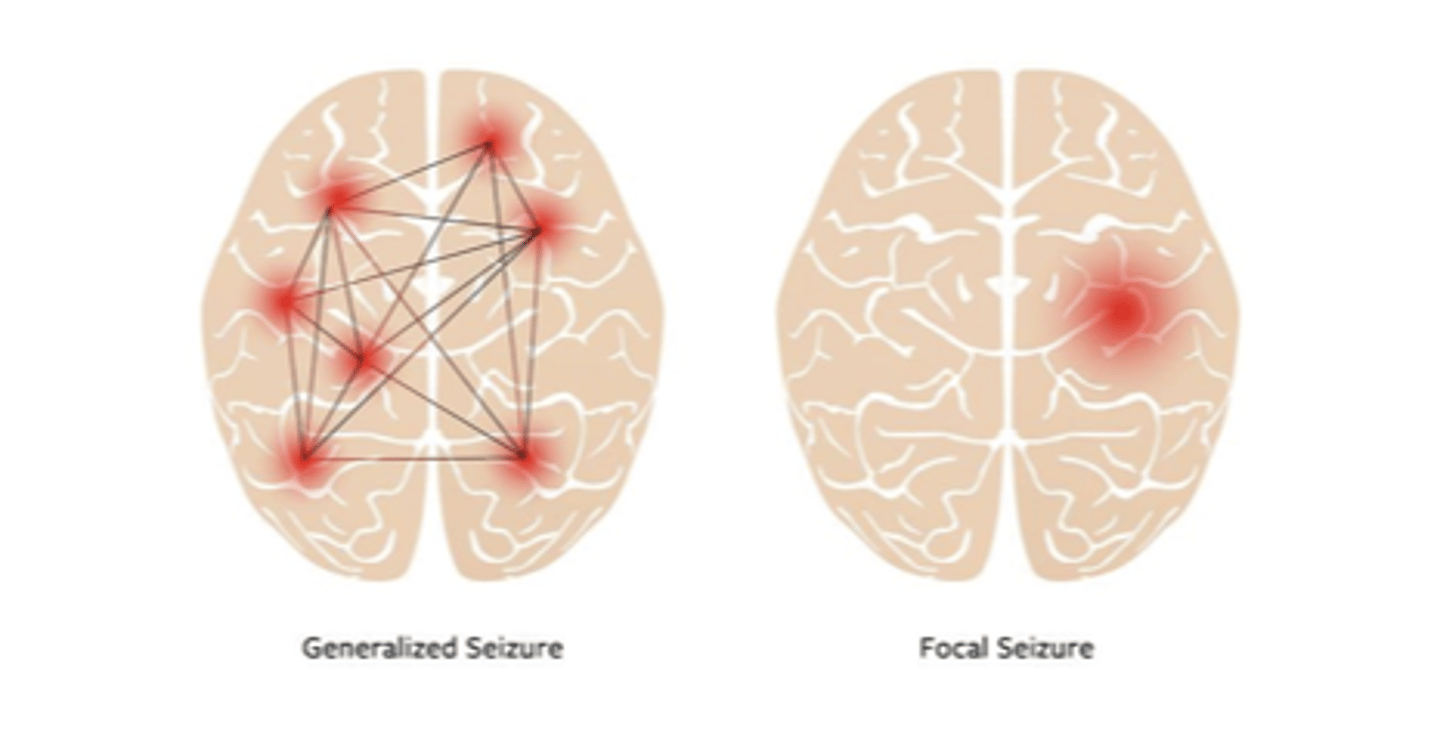 <p>potential onset symptoms --&gt; start on one side of brain (symptoms SOMETIMES affect awareness)</p><p>- focal-aware seizures</p><p>- Focal-impaired awareness seizures</p>