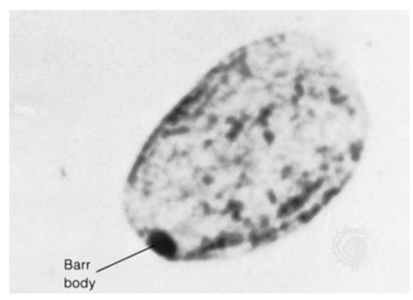 <p>A dense object lying along the inside of the nuclear envelope in cells of female mammals, representing a highly condensed, inactivated X chromosome.</p>