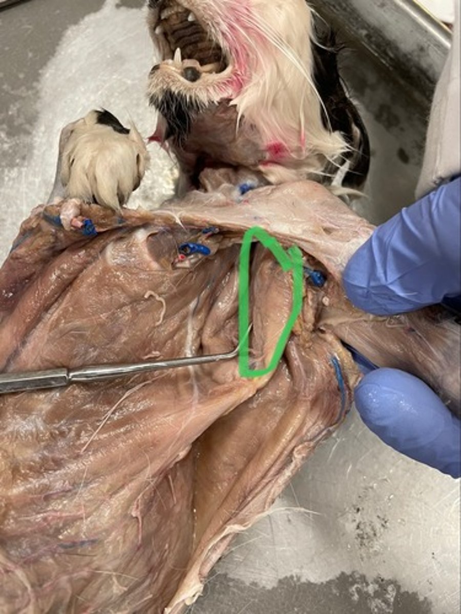 <p>O: subscapular fossa of scapula</p><p>I: lesser tubercle of scapula</p><p>A: stabilizes humerus; rotate shoulder medially</p>