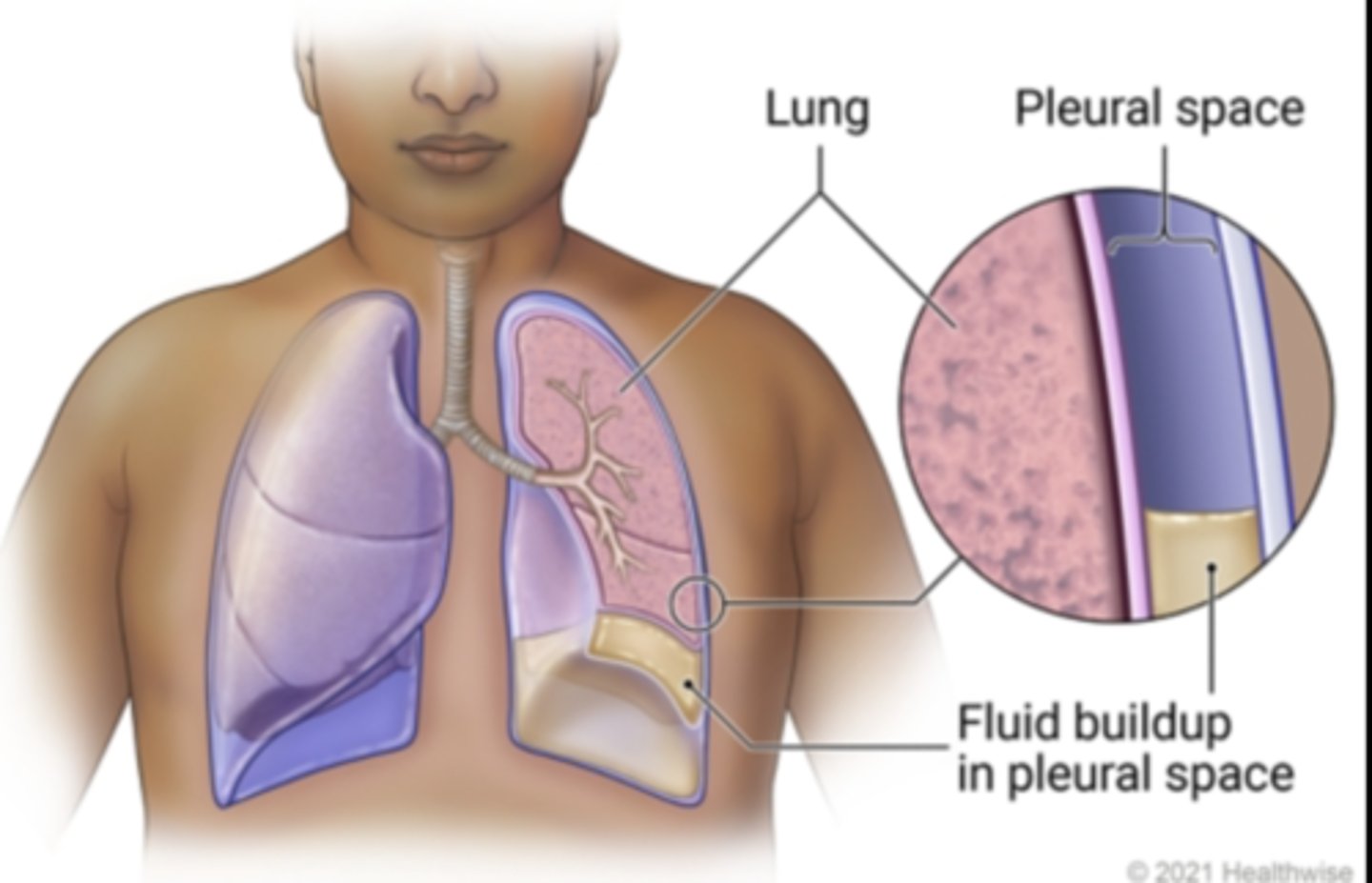 <p>Lubrication: Reduces friction between the pleura during respiratory movements.</p><p>Cohesion: Keeps the two pleural layers in close contact, facilitating lung expansion during inspiration.</p>