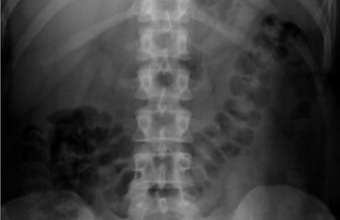 <p>What is this and what type of scan </p>