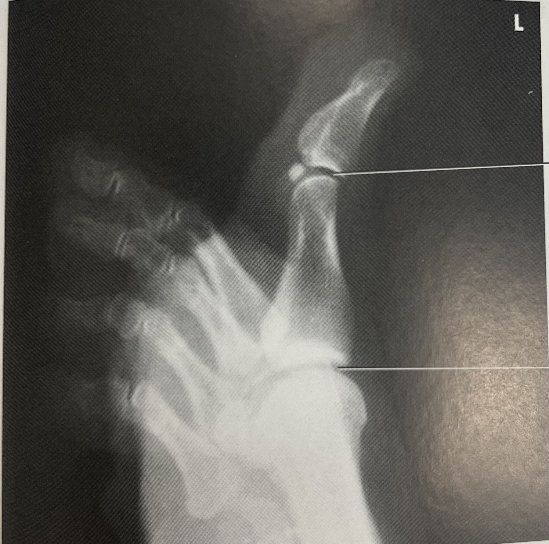 <p>identify part <strong>position</strong> of the image </p>