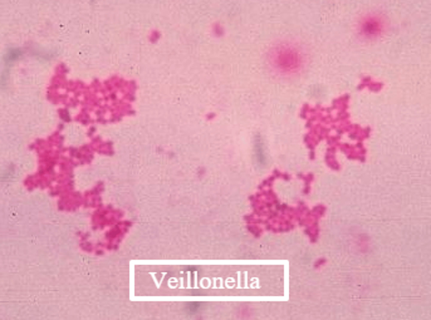 <p>- -ve cocci</p><p>- anaerobic</p><p>- associated w/ dental plaque &amp; gingival health, as they metabolise lactate</p><p>- grows on anaerobic media</p><p>- does not ferment carbohydrates (uses lactate)</p>