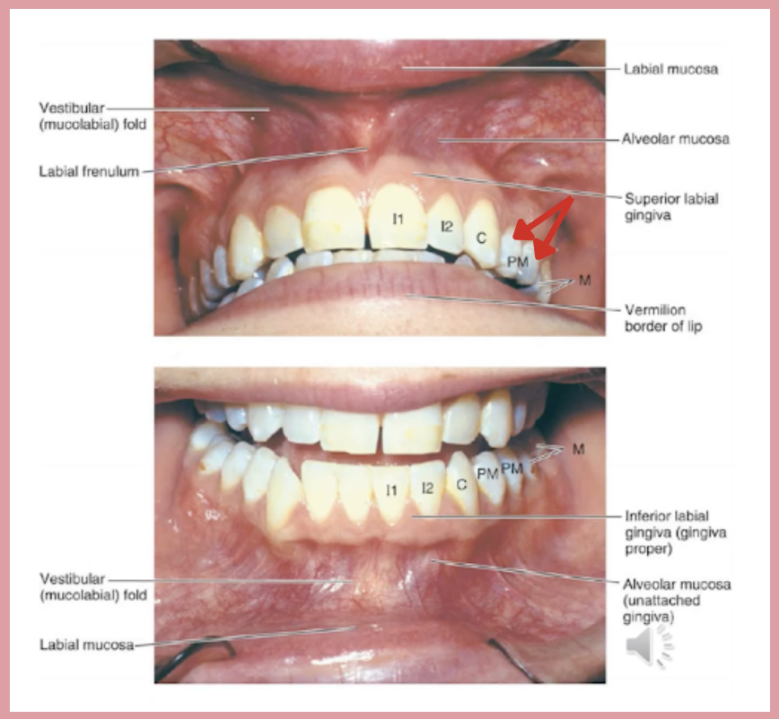 <p>Teeth pointed by the red arrow is innervated by which nerve?</p><p>a. Posterior superior alveolar branch</p><p>b. Middle superior alveolar branch</p><p>c. Anterior superior alveolar branch</p>
