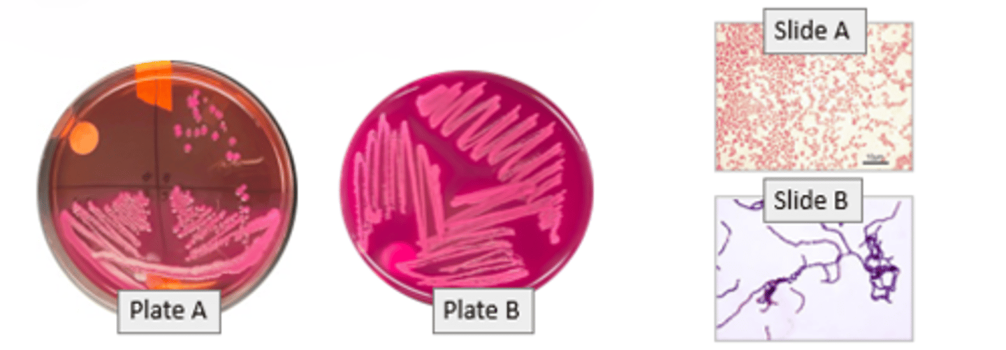 <p>-Selective and differential media</p><p>-selective for gram-negative organism</p><p>-plate A shows isolated colonies</p><p>-slide A shows gram stained bacteria (pink/red)</p>
