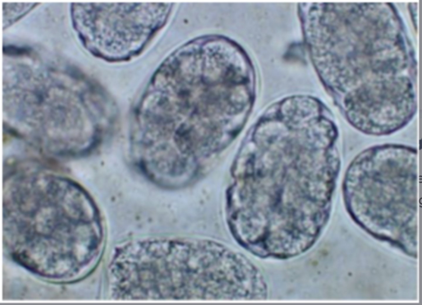 <p>These eggs were found on the fecal flotation of an 8 week old puppy. They measure approximately 60 * 40 um. What is your diagnosis?</p>