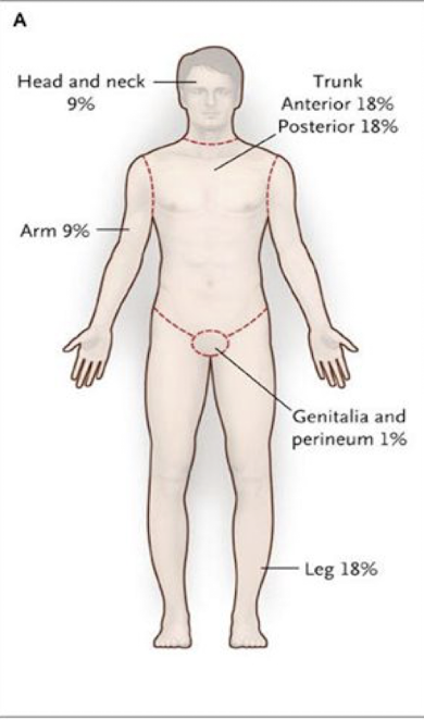 <p>-Head and neck <strong>9% </strong><br>-Each arm (front/back) <strong>9% </strong><br>-Anterior trunk<strong> 18% </strong><br>-Each leg (front/back) <strong>18% </strong><br>-Posterior trunk<strong> 18%</strong><br>-Genitals<strong> 1%</strong></p><p><em>*indicated for adult patients with BMI&lt;30</em></p>