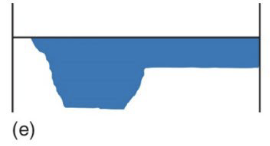 <p>This picture represents:</p>