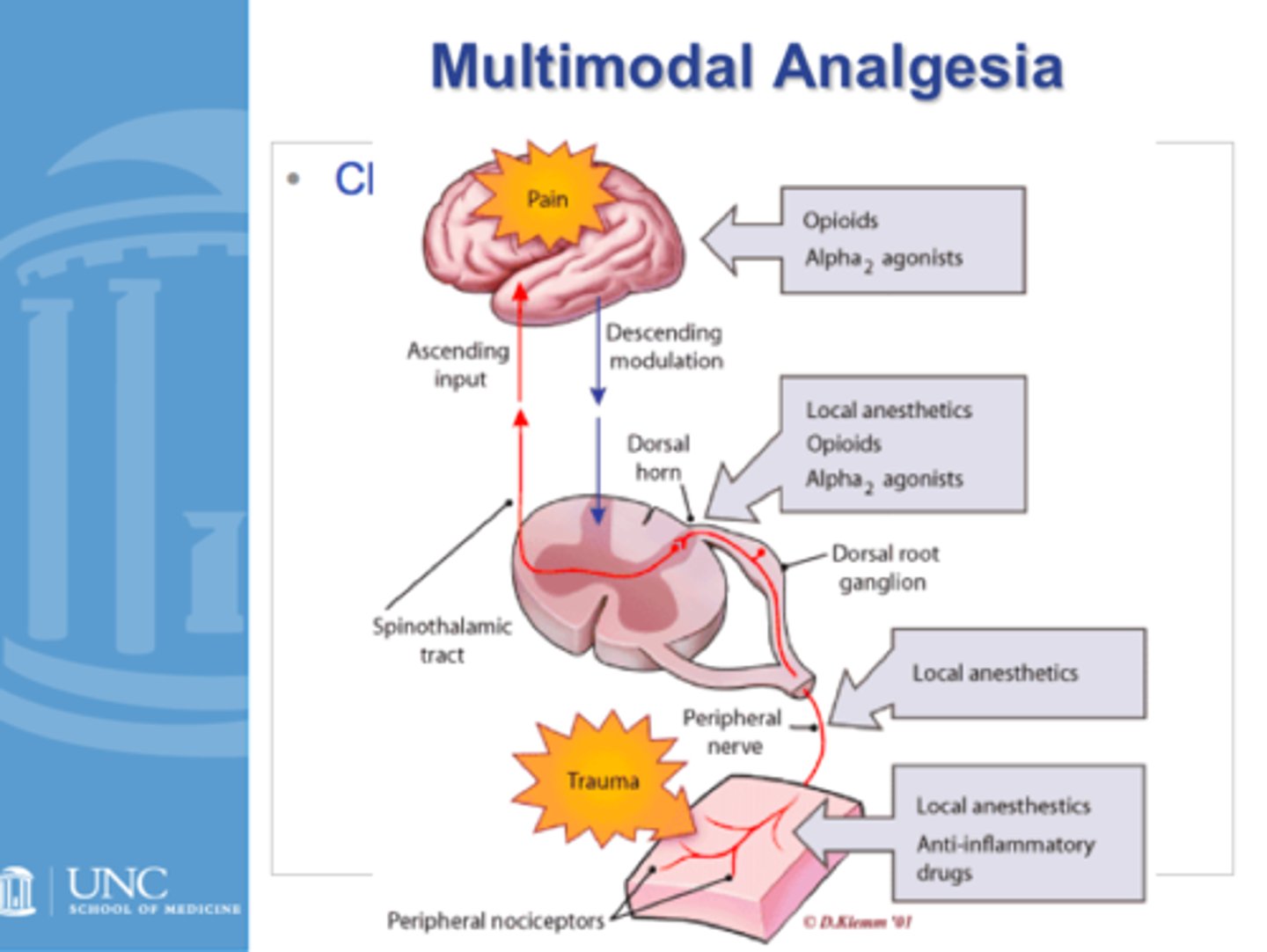 <p>- patient education</p><p>- expectation management!!</p><p>- non-pharm therapy (RICE, physical therapy)</p><p>- NSAIDs/APAP</p><p>- opioids (oral is preferred)</p><p>- ketamine</p><p>- lidocaine (mayhaps)</p>