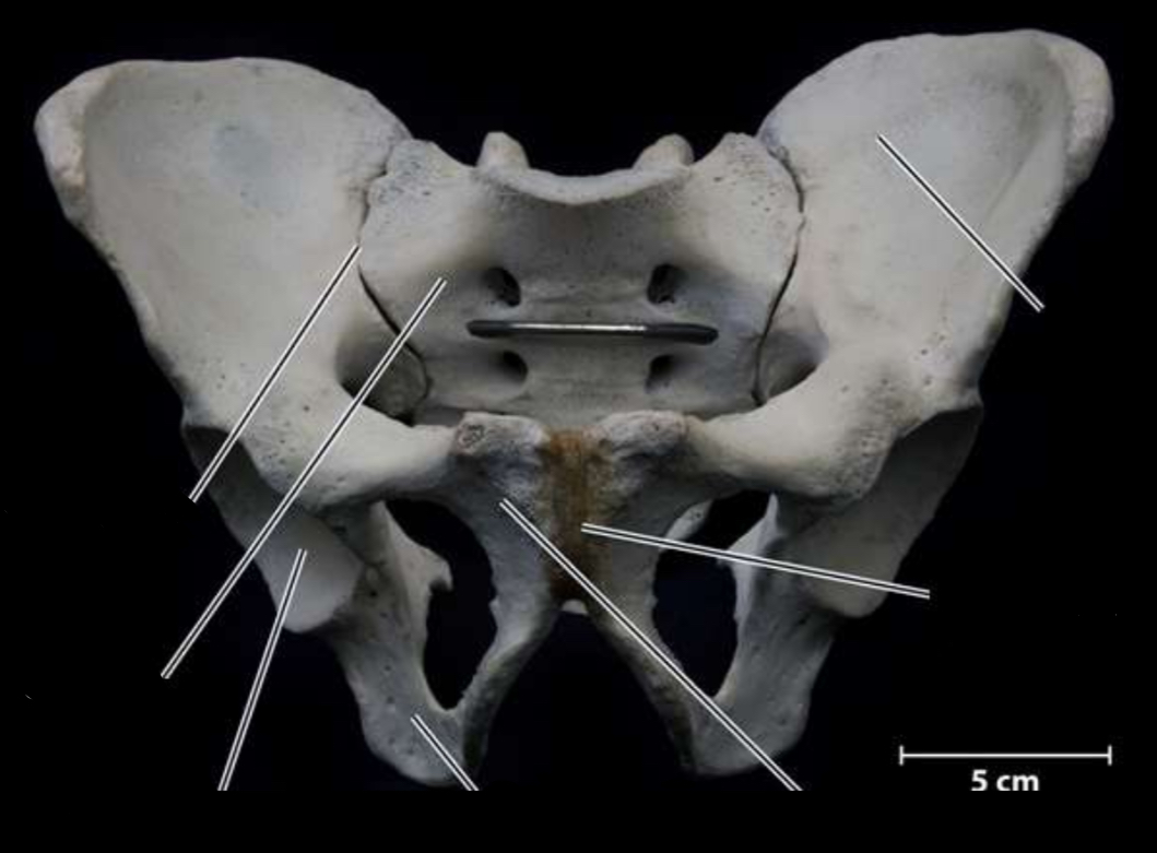 <p>Identify the sacrum</p>