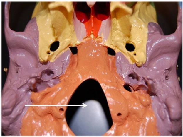 <p>Name this foramen.</p>