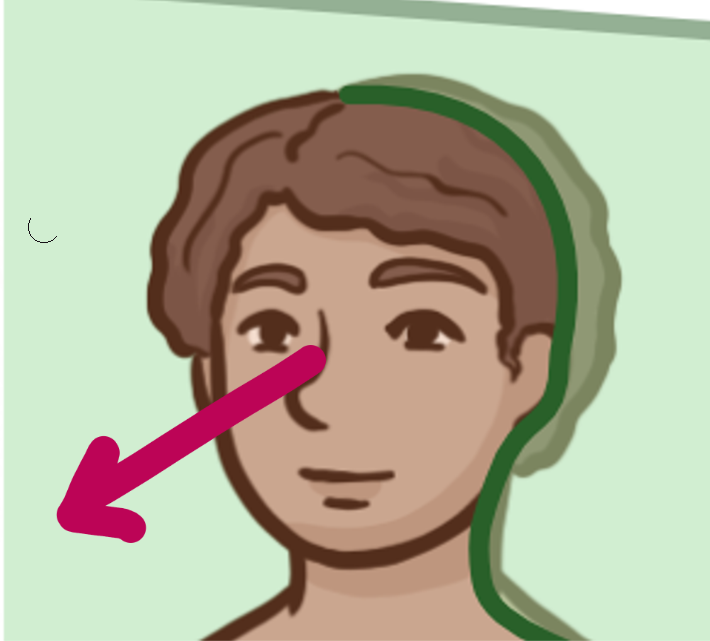 <p>Which brain-body orientation is this</p>