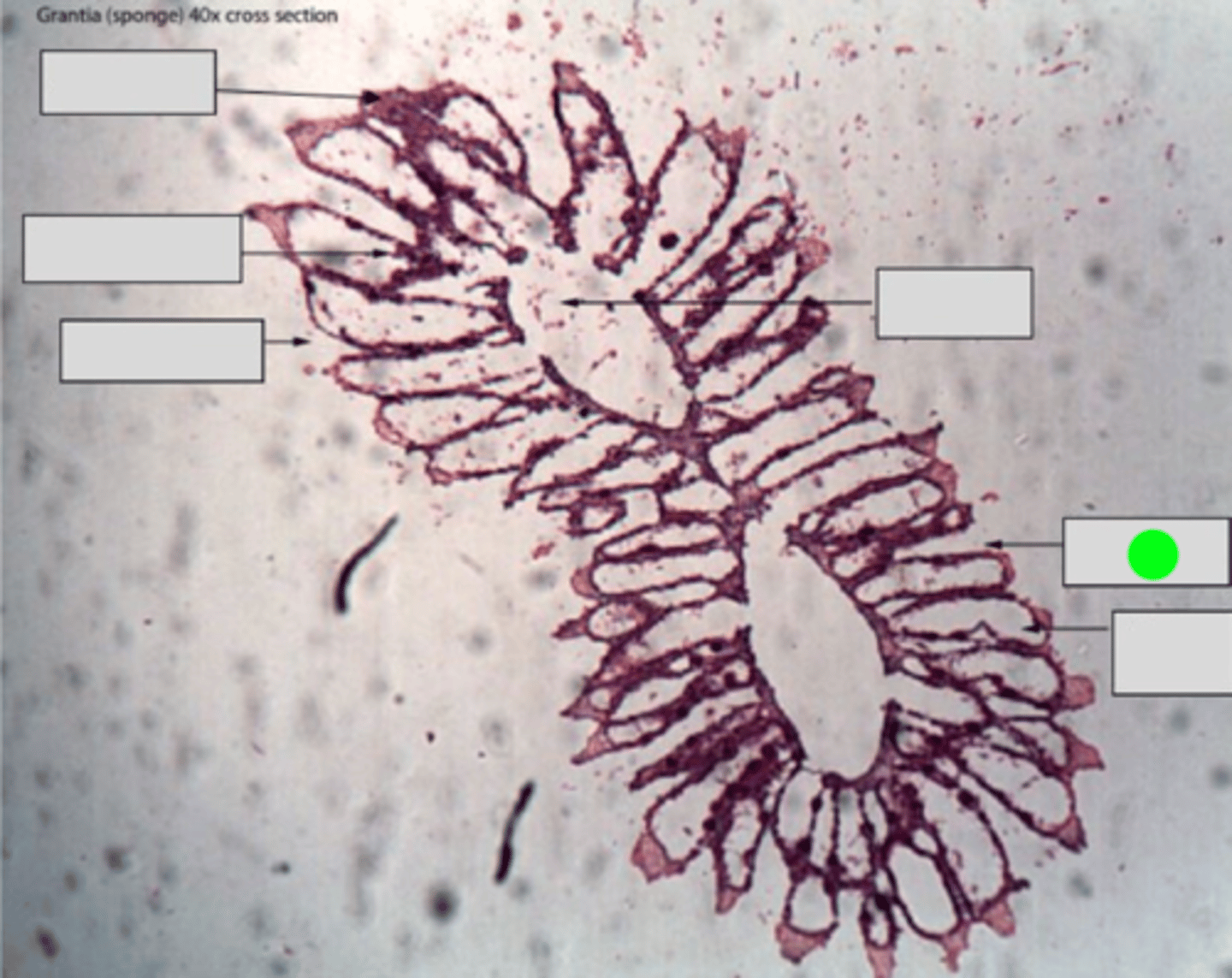 <p>These are the canals through which water enters the sponge's body. They bring in water containing food particles and oxygen.</p>