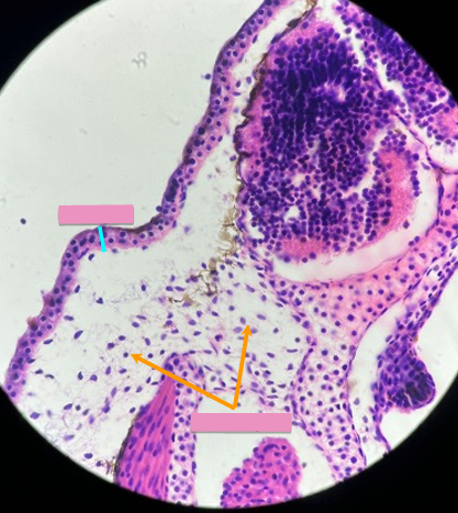 <p>what level<br>primary brain vesicle<br>parts</p>