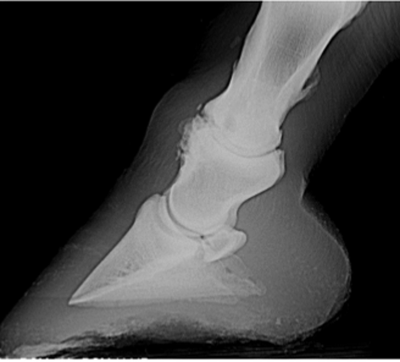 <p>What is the preferred treatment for this problem?</p>