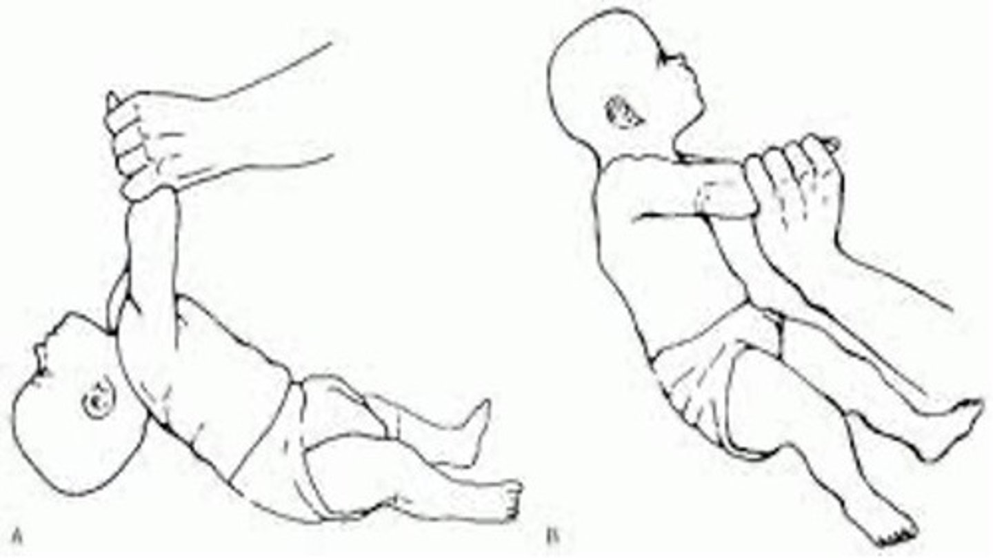 <p>Newborn: complete head lag</p><p>3 months: slight lag</p><p>4-6 months: no lag</p><p>&gt; 6 months: lift head spontaneously and repeatedly in anticipation</p>