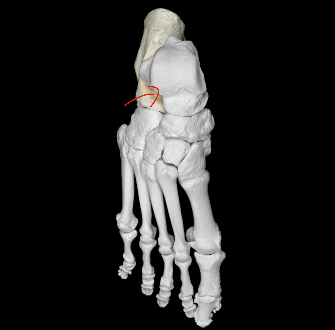 <p>ridge before calcaneus articulates with talus </p>