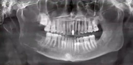<p>how would you describe the borders of this lesion</p>