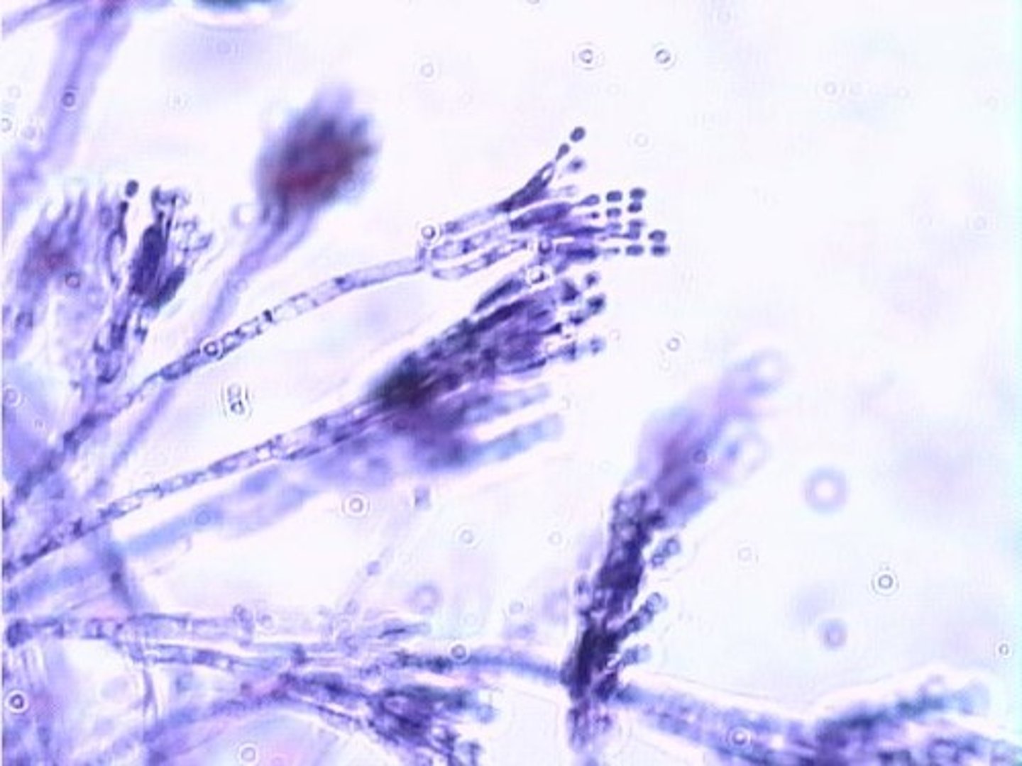<p>conidiophore produces identical conidia</p>
