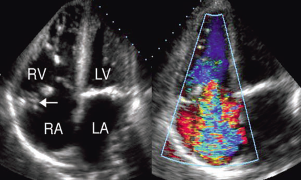 <p>what is seen here?</p>
