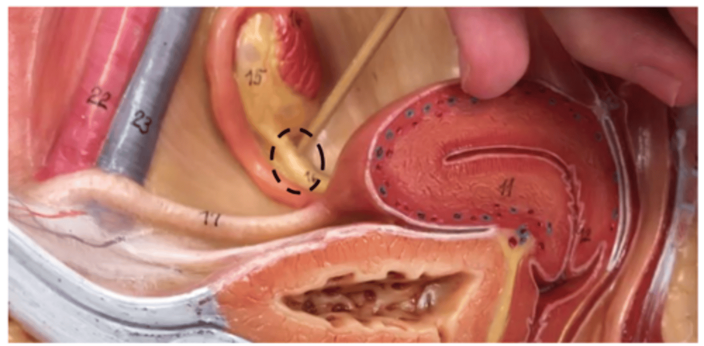 <p>attaches to ovary</p>