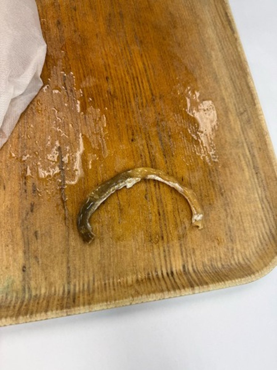 <p>Provide morphological diagnosis</p>