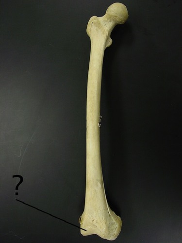 <p>articulates with the lateral condyle of the tibia</p>