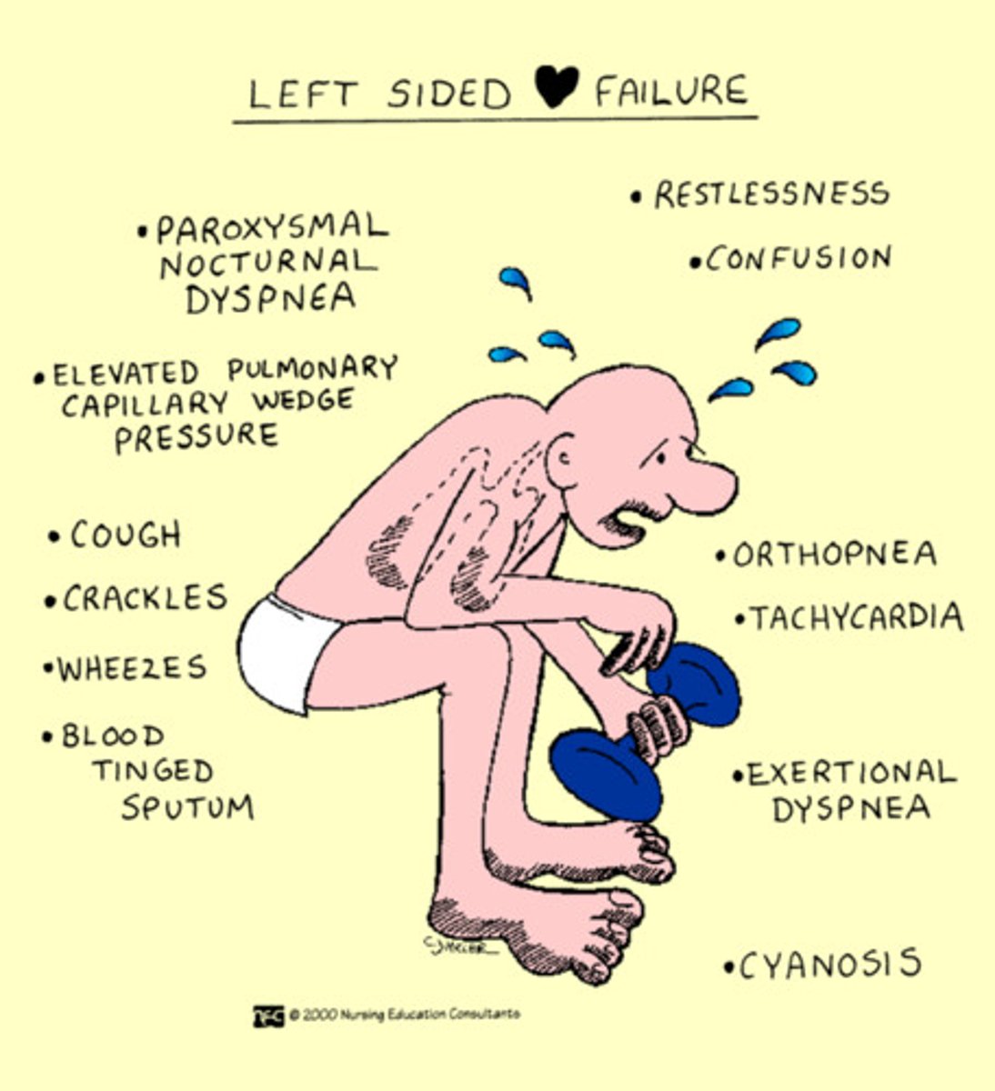 <p>Fatigue, Confusion, Dizziness, Sob, Oliguria, Crackles, Pulmonary congestion, Pink frothy sputum</p>