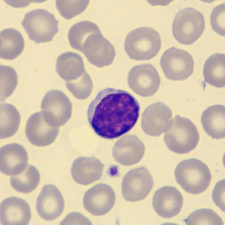 <p>What is this leukocyte?</p>