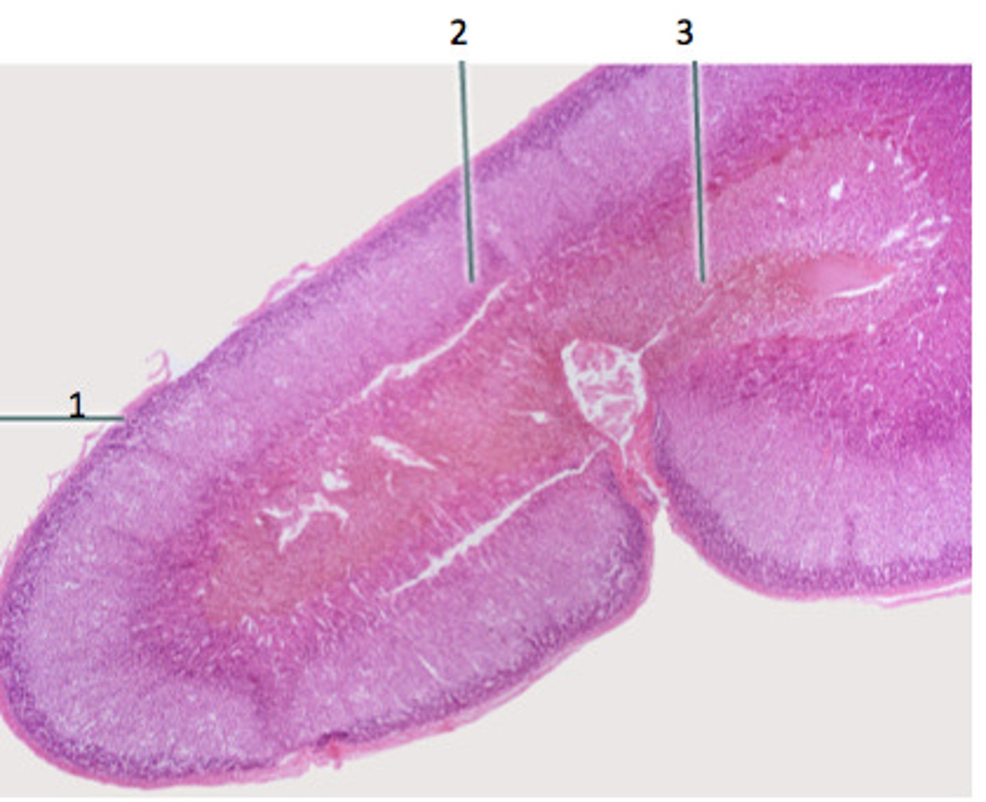 <p>3, inside of gland</p>