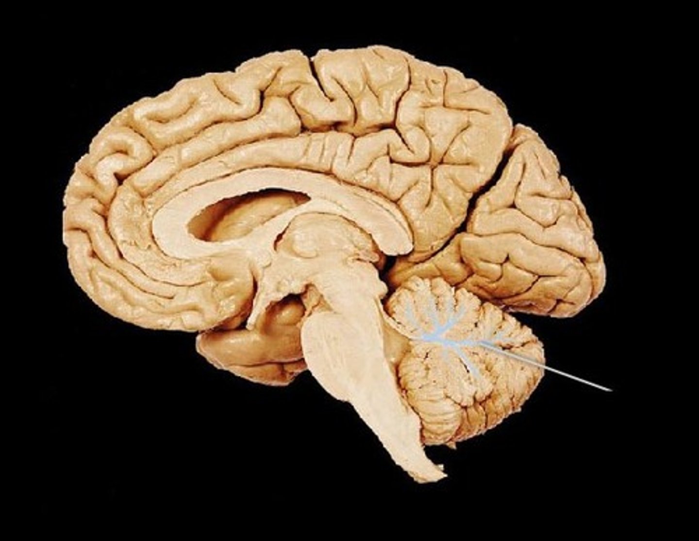 <p>ID matter of cerebellum</p>