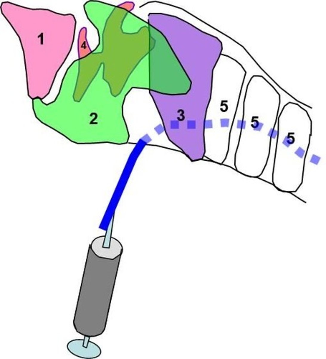 <p>During a transtracheal wash, a catheter is inserted between what two landmarks?</p>