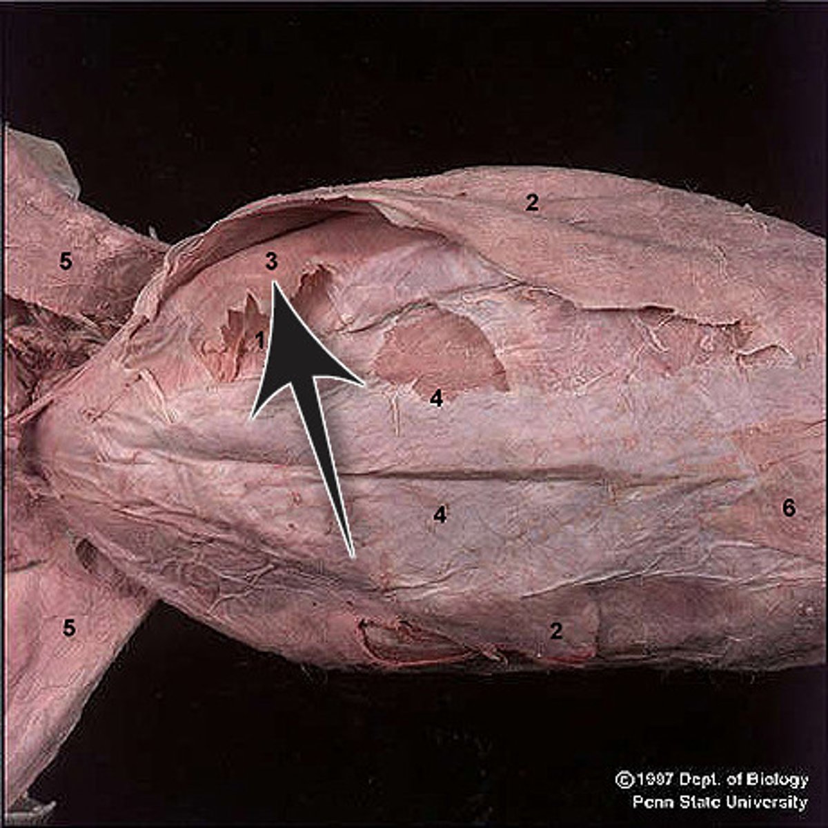 <p>name this muscle</p>