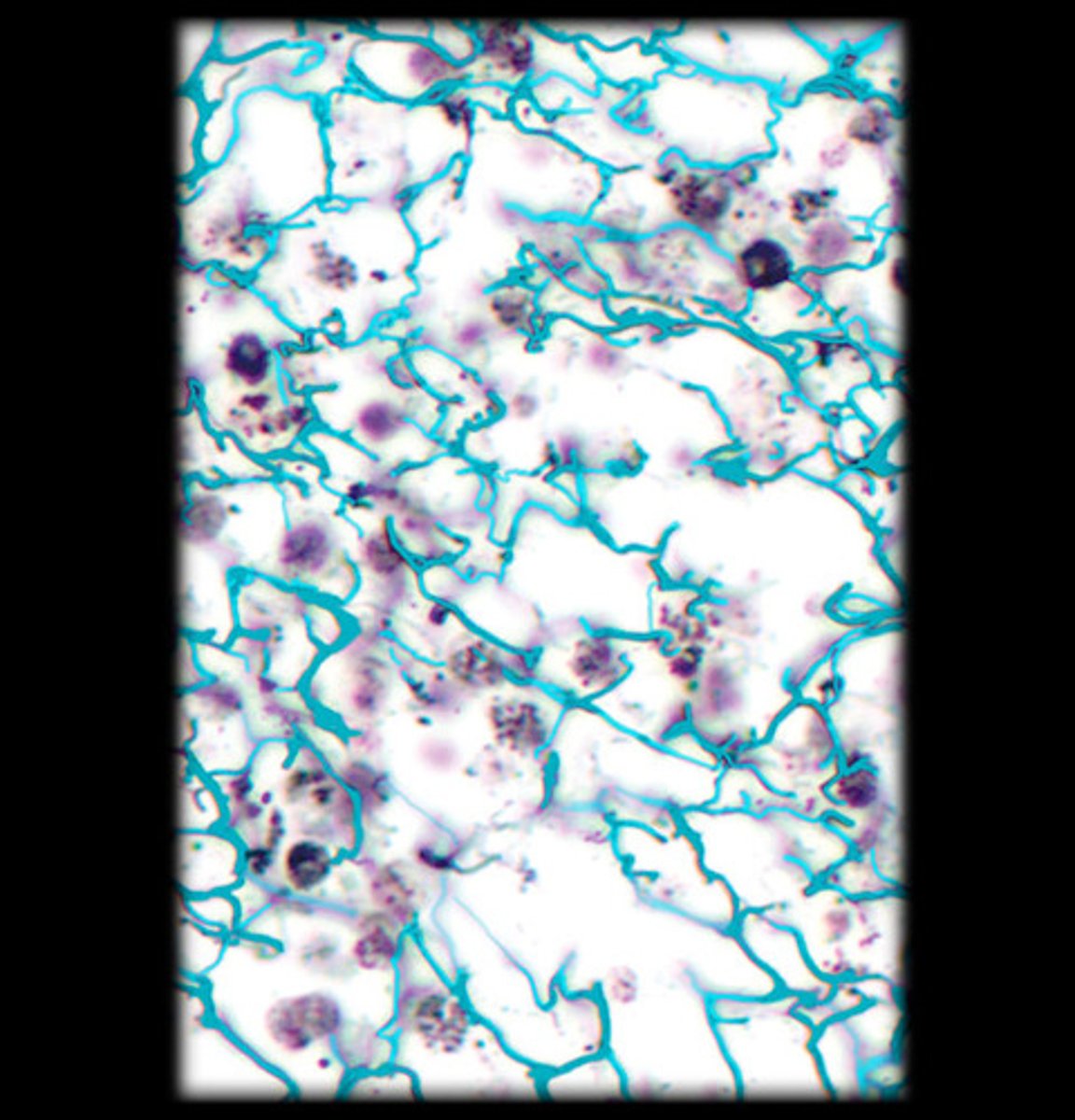 <p>- Thick, strong fibers that provide tensile strength.</p><p>- Appear as wavy, pink or reddish strands in stained tissue sections.</p>