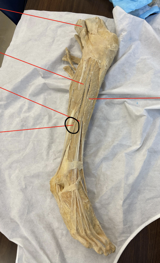 <p>identify + state origin, insertion, action, innervation of marked structure</p>