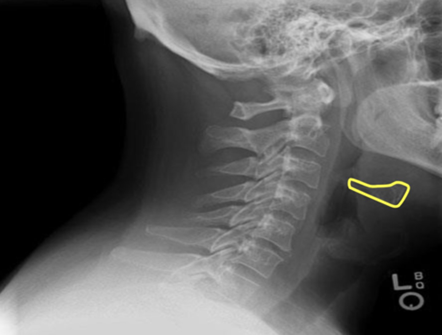 <p>What is outlined in yellow?</p>