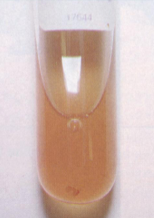 <p><span style="font-size: calc(var(--scale-factor)*39.96px)">Abdominocentesis</span><br>Colours</p><p>What does this mean?</p>