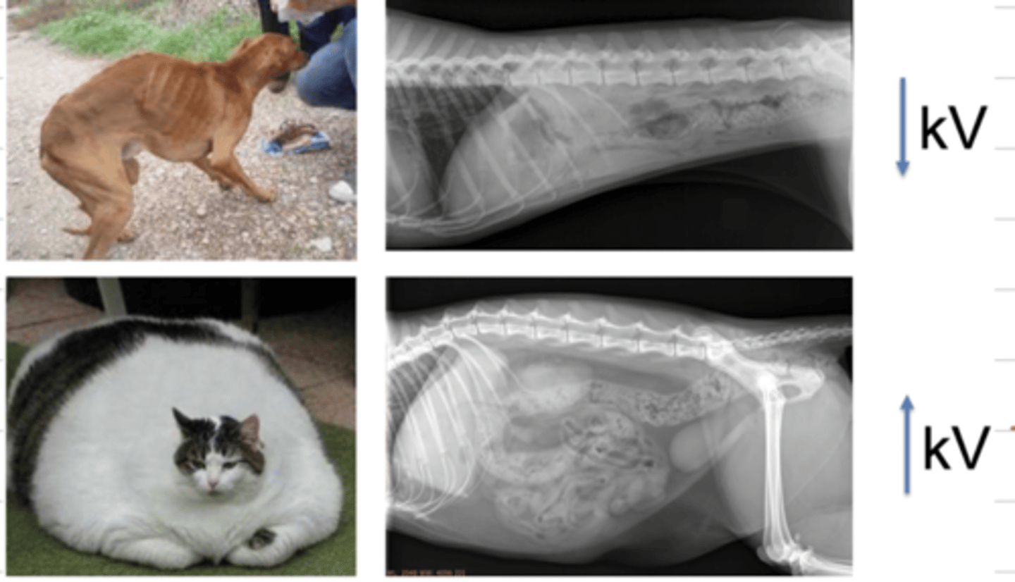 <p>we should use a high kV, because there is more tissue that the xrays need to pass through</p>