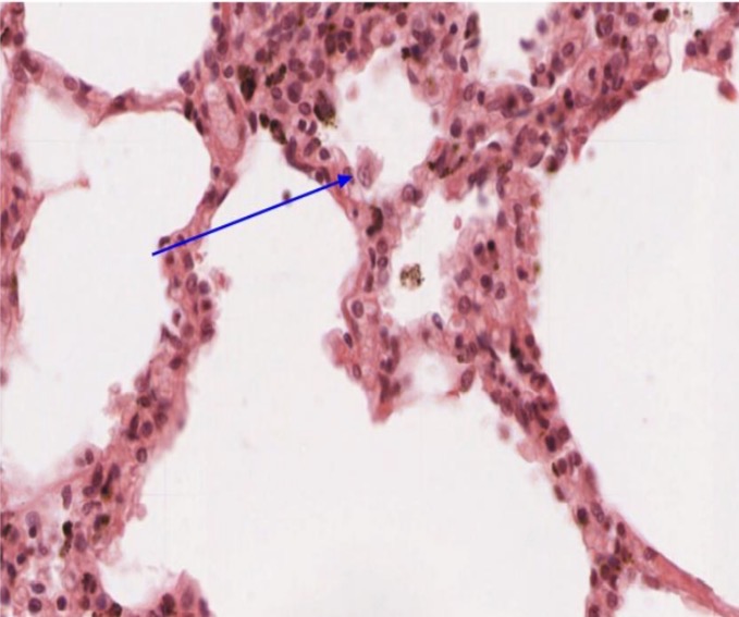 <p>Macrófago móvil macrófago alveolar </p>