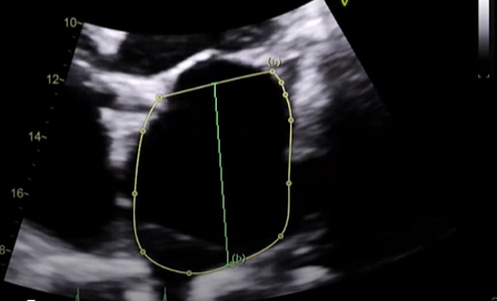 <p>what measure measurement is this, explain how would want to measure this and what View,</p>