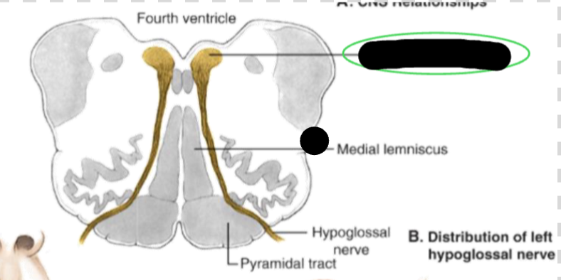 <p>what CN is the picture showing?</p>