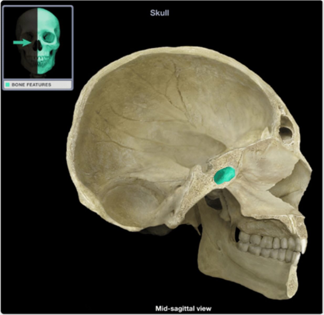 <p>sinus that sits just UNDER the sella turcica. It is posterior to the nose, and slightly superior</p>