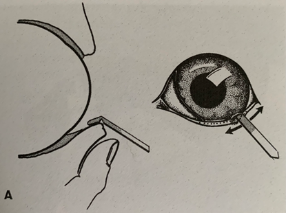 <p>Aanwezigheid van:</p><ul><li><p>Scherp reflextiebeeldje cornea</p></li><li><p>Ononderbroken reflecterend en helder vochtrandje tussen (onder)ooglidrand of tussen de rand van de membrana nictitans en de cornea</p></li></ul><p></p><p>Bepaling van de waterige fractie van de traanproductie mbv de Schirmer-tear-test (STT)</p><ol><li><p>Stripje omvouwen thv de inkeping</p></li><li><p>Verpakking openen van achteraf en pak het stripje met een steriele pincet uit de verpakking</p></li><li><p>De teststrip wordt op ⅓ van lateraal in de ventrale conjunctivaalzak aangebracht en het tijdstip wordt genoteerd</p></li><li><p>Leg je vingertoppen zacht op de oogleden</p></li><li><p>Haal de teststrip na 1 minuut uit de conjunctivaalzak en lees het direct af</p></li></ol>