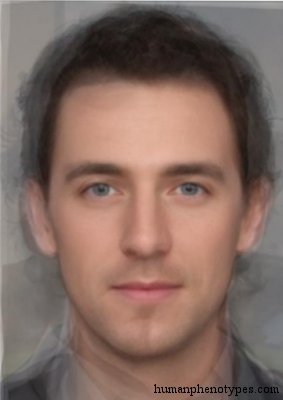<p>Identify this Phenotype</p>